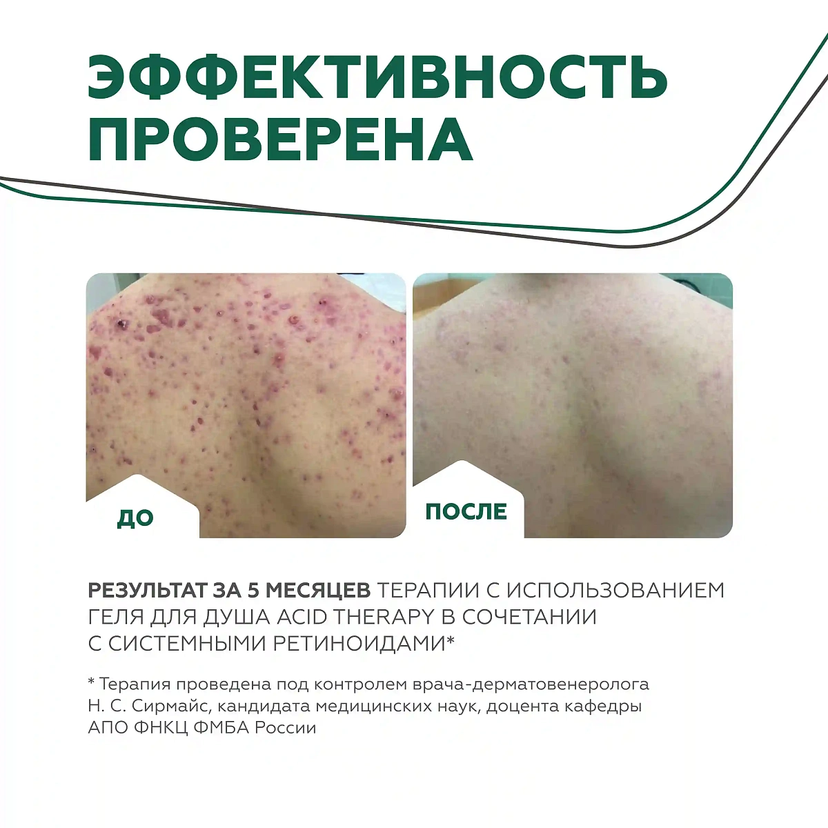 Душқа арналған Acid Therapy гелі 12