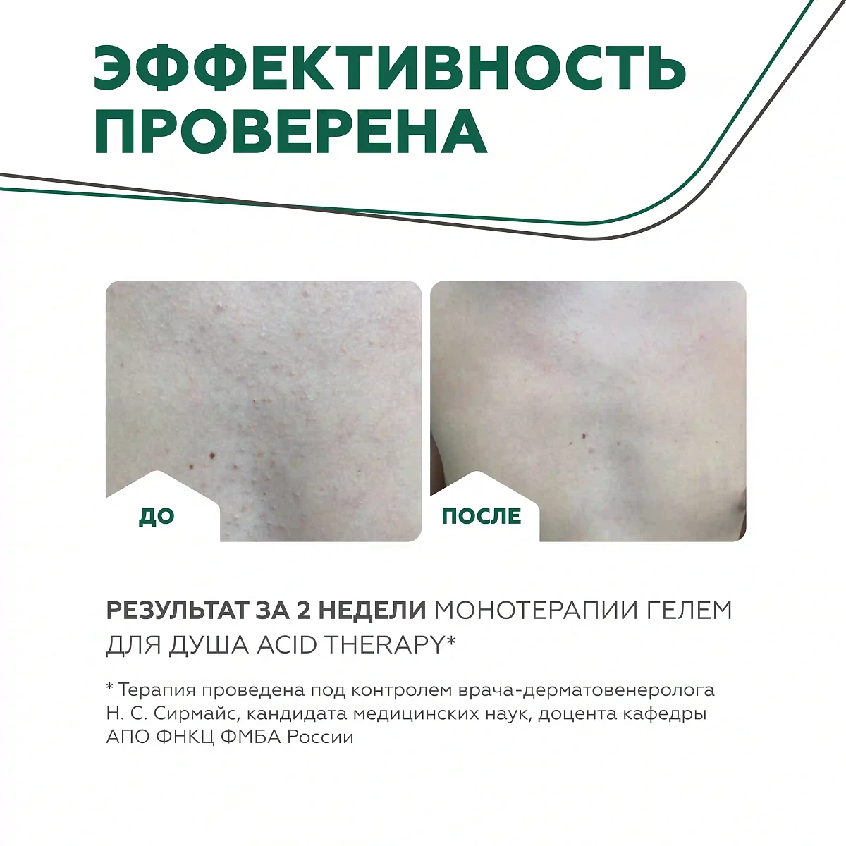 Душқа арналған Acid Therapy гелі 13